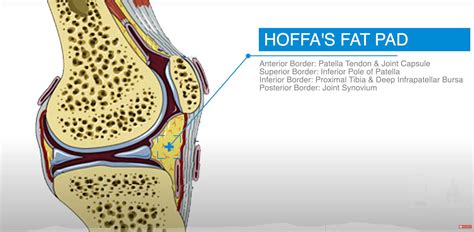 adipositas icd10|fat pad impingement icd 10.